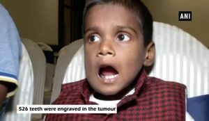 Һиндстанда бер малайның ярты меңнән артык тешен алганнар - видео