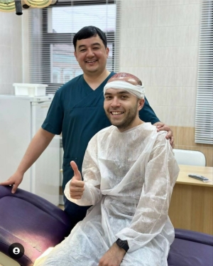 Блогер Искәндәр Гайсин чәч күчереп утырту буенча операция ясаткан – фото