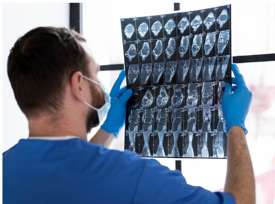Рентгенолог:  «Йөкле хатын-кызларның яралгысына рентген нурланышы зур зыян сала»