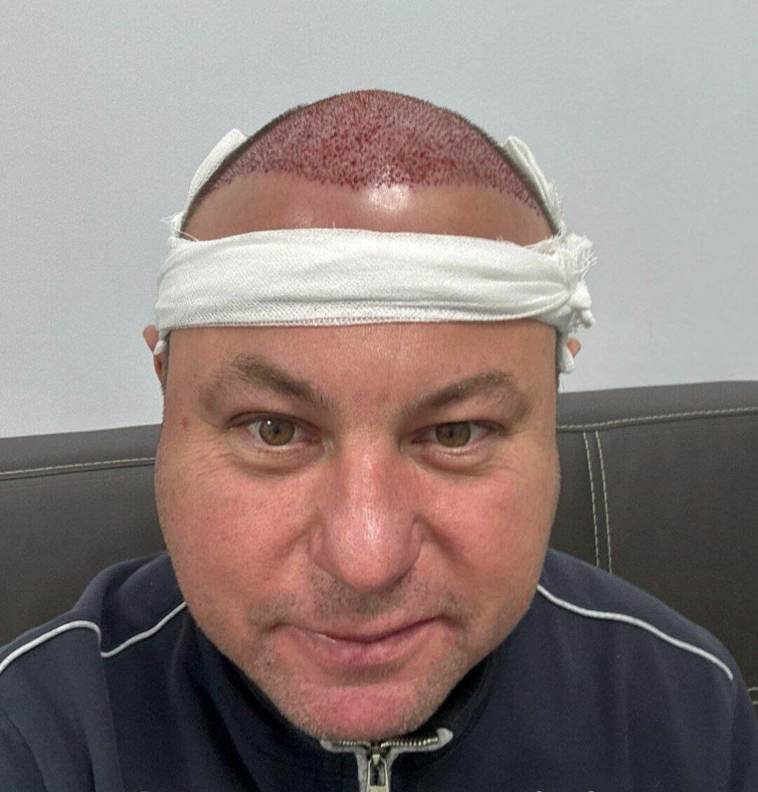 Илнар Сәйфиев операция ясаткан